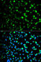 Thymidine Phosphorylase antibody, 13-864, ProSci, Immunofluorescence image 
