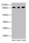 Lysyl Oxidase Like 2 antibody, LS-C369938, Lifespan Biosciences, Western Blot image 