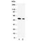 Follistatin Like 3 antibody, R31015, NSJ Bioreagents, Western Blot image 
