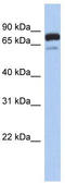 Myotubularin Related Protein 12 antibody, TA335965, Origene, Western Blot image 