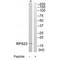 Ribosomal Protein S23 antibody, A07272, Boster Biological Technology, Western Blot image 