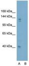 GLI Family Zinc Finger 2 antibody, GTX46056, GeneTex, Western Blot image 