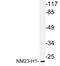 NME/NM23 Nucleoside Diphosphate Kinase 1 antibody, LS-B12563, Lifespan Biosciences, Western Blot image 