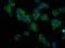 Potassium Sodium-Activated Channel Subfamily T Member 1 antibody, LS-C674199, Lifespan Biosciences, Immunofluorescence image 