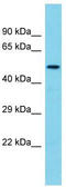 Transmembrane Protein 143 antibody, TA330673, Origene, Western Blot image 