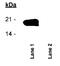 Baculoviral IAP Repeat Containing 5 antibody, NB500-236, Novus Biologicals, Western Blot image 