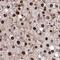 Insulin gene enhancer protein ISL-1 antibody, NBP2-33831, Novus Biologicals, Immunohistochemistry frozen image 