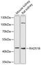 RAD51 Paralog B antibody, GTX64635, GeneTex, Western Blot image 