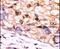 CTD Small Phosphatase 1 antibody, PA5-15576, Invitrogen Antibodies, Immunohistochemistry paraffin image 