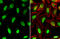 Protein Phosphatase, Mg2+/Mn2+ Dependent 1D antibody, GTX130700, GeneTex, Immunocytochemistry image 