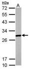 Enoyl-CoA Hydratase, Short Chain 1 antibody, PA5-30014, Invitrogen Antibodies, Western Blot image 