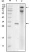 Inhibitor Of Nuclear Factor Kappa B Kinase Subunit Epsilon antibody, abx010992, Abbexa, Enzyme Linked Immunosorbent Assay image 