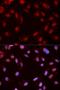 Checkpoint Kinase 1 antibody, orb129560, Biorbyt, Immunofluorescence image 