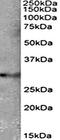 Tetraspanin 14 antibody, orb12291, Biorbyt, Western Blot image 