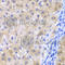 Glutathione Peroxidase 4 antibody, A1933, ABclonal Technology, Immunohistochemistry paraffin image 