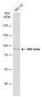 Inhibitor Of Nuclear Factor Kappa B Kinase Subunit Beta antibody, GTX105690, GeneTex, Western Blot image 