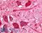 Proprotein Convertase Subtilisin/Kexin Type 6 antibody, LS-A8408, Lifespan Biosciences, Immunohistochemistry paraffin image 