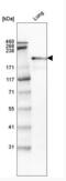 Laminin Subunit Beta 2 antibody, NBP2-42387, Novus Biologicals, Western Blot image 