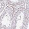 Transmembrane Protein 119 antibody, PA5-62505, Invitrogen Antibodies, Immunohistochemistry paraffin image 
