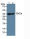 Carbonic Anhydrase 3 antibody, LS-C300862, Lifespan Biosciences, Western Blot image 