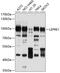 Prolyl 3-Hydroxylase 1 antibody, 13-580, ProSci, Western Blot image 