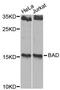 BCL2 Associated Agonist Of Cell Death antibody, A1593, ABclonal Technology, Western Blot image 