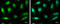 SMAD Family Member 3 antibody, GTX108638, GeneTex, Immunocytochemistry image 