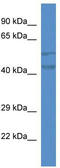 Transmembrane Protein 102 antibody, TA334134, Origene, Western Blot image 