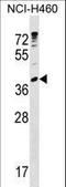 Ubiquitin Conjugating Enzyme E2 U antibody, LS-C160387, Lifespan Biosciences, Western Blot image 