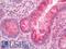 Interferon Alpha 2 antibody, LS-C317407, Lifespan Biosciences, Immunohistochemistry paraffin image 