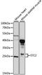 Stanniocalcin 2 antibody, STJ112433, St John