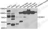 Scm Polycomb Group Protein Homolog 1 antibody, A7362, ABclonal Technology, Western Blot image 