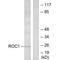 Ras Like Without CAAX 1 antibody, A06008, Boster Biological Technology, Western Blot image 