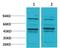 Bestrophin 2 antibody, A09693, Boster Biological Technology, Western Blot image 