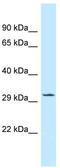 TOR Signaling Pathway Regulator antibody, TA343190, Origene, Western Blot image 