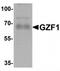 GDNF Inducible Zinc Finger Protein 1 antibody, TA320001, Origene, Western Blot image 