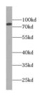 Transient Receptor Potential Cation Channel Subfamily C Member 4 Associated Protein antibody, FNab09017, FineTest, Western Blot image 