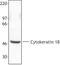 Keratin 18 antibody, LS-B1669, Lifespan Biosciences, Western Blot image 