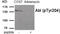 ABL Proto-Oncogene 1, Non-Receptor Tyrosine Kinase antibody, 79-953, ProSci, Western Blot image 