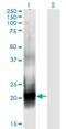 Rac Family Small GTPase 2 antibody, H00005880-M08, Novus Biologicals, Western Blot image 