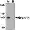 NPHS1 Adhesion Molecule, Nephrin antibody, orb74410, Biorbyt, Western Blot image 
