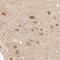 ATP Synthase F1 Subunit Delta antibody, HPA002865, Atlas Antibodies, Immunohistochemistry frozen image 