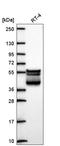 Keratin 80 antibody, HPA077836, Atlas Antibodies, Western Blot image 