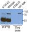 Intraflagellar Transport 88 antibody, 13967-1-AP, Proteintech Group, Immunoprecipitation image 