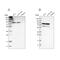 THO Complex 1 antibody, PA5-53922, Invitrogen Antibodies, Western Blot image 