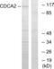 Cell Division Cycle Associated 2 antibody, abx013936, Abbexa, Western Blot image 