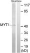 Protein Kinase, Membrane Associated Tyrosine/Threonine 1 antibody, TA312141, Origene, Western Blot image 