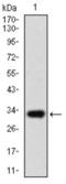 ATP Binding Cassette Subfamily G Member 5 antibody, abx015759, Abbexa, Western Blot image 