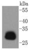 Major Histocompatibility Complex, Class II, DR Alpha antibody, A01195-2, Boster Biological Technology, Western Blot image 