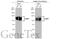 Lysosomal Associated Membrane Protein 1 antibody, GTX634336, GeneTex, Western Blot image 